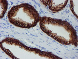 SRPRB Antibody - IHC of paraffin-embedded Human prostate tissue using anti-SRPRB mouse monoclonal antibody.
