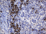 SRPRB Antibody - IHC of paraffin-embedded Human lymph node tissue using anti-SRPRB mouse monoclonal antibody. (Heat-induced epitope retrieval by 10mM citric buffer, pH6.0, 120°C for 3min).