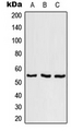 SRSF11 / SFRS11 Antibody - Western blot analysis of SFRS11 expression in NCI-H292 (A); SP2/0 (B); H9C2 (C) whole cell lysates.