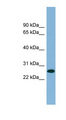 SRSF12 Antibody - SRSF12 / SFRS13B antibody Western blot of PANC1 cell lysate. This image was taken for the unconjugated form of this product. Other forms have not been tested.