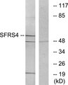 SRSF4 / SFRS4 Antibody - Western blot analysis of lysates from LOVO cells, using SFRS4 Antibody. The lane on the right is blocked with the synthesized peptide.
