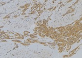 SRXN1 Antibody - 1:100 staining human lung tissue by IHC-P. The sample was formaldehyde fixed and a heat mediated antigen retrieval step in citrate buffer was performed. The sample was then blocked and incubated with the antibody for 1.5 hours at 22°C. An HRP conjugated goat anti-rabbit antibody was used as the secondary.
