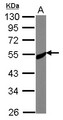 SS18L1 / CREST Antibody - Sample (30 ug of whole cell lysate) A: MCF-7 10% SDS PAGE SS18L1 antibody diluted at 1:1000