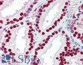 SSB / La Antibody - Anti-SSB antibody IHC of human prostate. Immunohistochemistry of formalin-fixed, paraffin-embedded tissue after heat-induced antigen retrieval. Antibody concentration 5 ug/ml.  This image was taken for the unconjugated form of this product. Other forms have not been tested.