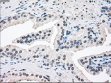 SSB / La Antibody - Immunohistochemical staining of paraffin-embedded prostate tissue using anti-SSB mouse monoclonal antibody. (Dilution 1:50).