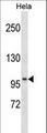 SSH1 Antibody - SSH1 Antibody western blot of HeLa cell line lysates (35 ug/lane). The SSH1 antibody detected the SSH1 protein (arrow).