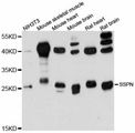 SSPN / Sarcospan Antibody - Western blot analysis of extracts of various cell lines, using SSPN antibody at 1:3000 dilution. The secondary antibody used was an HRP Goat Anti-Rabbit IgG (H+L) at 1:10000 dilution. Lysates were loaded 25ug per lane and 3% nonfat dry milk in TBST was used for blocking. An ECL Kit was used for detection and the exposure time was 90s.