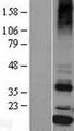 SSR4 Protein - Western validation with an anti-DDK antibody * L: Control HEK293 lysate R: Over-expression lysate