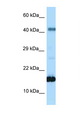 SST / Somatostatin Antibody - SST / Somatostatin antibody Western blot of Rat Liver lysate. Antibody concentration 1 ug/ml.  This image was taken for the unconjugated form of this product. Other forms have not been tested.