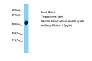 SSTR1 Antibody -  This image was taken for the unconjugated form of this product. Other forms have not been tested.