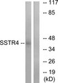 SSTR4 Antibody - Western blot analysis of lysates from LOVO cells, using SSTR4 Antibody. The lane on the right is blocked with the synthesized peptide.