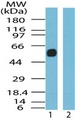 SSTR5 Antibody - Western blot ofSSTR5 in human pancreas cell lysate in the 1) absence and 2) presence of immunizing peptide using antibody at 0.25 ug/ml.