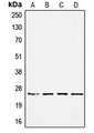 Antibody - Western blot analysis of SSX-pan expression in HEK293 (A); MDAMB453 (B); SW480 (C); A549 (D) whole cell lysates.