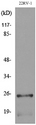 SSX Pan Antibody - Western blot analysis of lysate from 22RV-1 cells, using SSX1/2/3/4/5/6/7/8/9 Antibody.