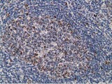SSX1 Antibody - IHC of paraffin-embedded Human lymph node tissue using anti-SSX1 mouse monoclonal antibody.