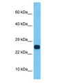 SSX2B Antibody - SSX2B antibody Western Blot of Thyroid Tumor. Antibody dilution: 1 ug/ml.  This image was taken for the unconjugated form of this product. Other forms have not been tested.
