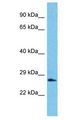SSX2B Antibody - SSX2B antibody Western Blot of Jurkat. Antibody dilution: 1 ug/ml.  This image was taken for the unconjugated form of this product. Other forms have not been tested.