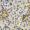 ST3GAL4 / ST3Gal IV Antibody - Immunohistochemical analysis of ST3GAL4 staining in rat kidney formalin fixed paraffin embedded tissue section. The section was pre-treated using heat mediated antigen retrieval with sodium citrate buffer (pH 6.0). The section was then incubated with the antibody at room temperature and detected using an HRP conjugated compact polymer system. DAB was used as the chromogen. The section was then counterstained with hematoxylin and mounted with DPX.