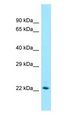 ST6GAL1 / CD75 Antibody - CD75 / ST6GAL1 antibody Western Blot of Human Kidney.  This image was taken for the unconjugated form of this product. Other forms have not been tested.