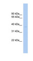 ST6GALNAC6 Antibody - ST6GALNAC6 antibody Western blot of Fetal Heart lysate. This image was taken for the unconjugated form of this product. Other forms have not been tested.