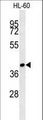 ST8SIA3 Antibody - SIA8C Antibody western blot of HL-60 cell line lysates (15 ug/lane). The SIA8C antibody detected the SIA8C protein (arrow).
