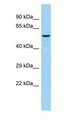 ST8SIA4 Antibody - ST8SIA4 antibody Western Blot of Rat Testis.  This image was taken for the unconjugated form of this product. Other forms have not been tested.