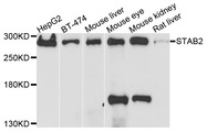 STAB2 / HARE Antibody - Western blot analysis of extracts of various cell lines, using STAB2 antibody at 1:1000 dilution. The secondary antibody used was an HRP Goat Anti-Rabbit IgG (H+L) at 1:10000 dilution. Lysates were loaded 25ug per lane and 3% nonfat dry milk in TBST was used for blocking. An ECL Kit was used for detection and the exposure time was 90s.