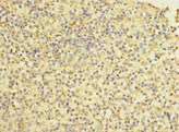 STAB2 / HARE Antibody - Immunohistochemistry of paraffin-embedded human spleen tissue at dilution 1:100