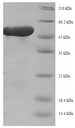 repD Protein - (Tris-Glycine gel) Discontinuous SDS-PAGE (reduced) with 5% enrichment gel and 15% separation gel.