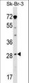 STAR Antibody - STAR Antibody western blot of SK-BR-3 cell line lysates (35 ug/lane). The STAR antibody detected the STAR protein (arrow).