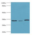 STARD10 Antibody - Western blot. All lanes: STARD10 antibody at 2 ug/ml Lane 1:293T whole cell lysate. Lane 2: k562 whole cell lysate Lane 3: mouse heart tissue. Secondary antibody: Goat polyclonal to rabbit at 1:10000 dilution. Predicted band size: 33 kDa. Observed band size: 33 kDa.  This image was taken for the unconjugated form of this product. Other forms have not been tested.