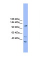 STARD8 Antibody - STARD8 antibody Western blot of 293T Cell lysate. Antibody concentration 1 ug/ml.  This image was taken for the unconjugated form of this product. Other forms have not been tested.