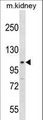 STAT2 Antibody - Mouse Stat2 Antibody western blot of mouse kidney tissue lysates (35 ug/lane). The Stat2 antibody detected the Stat2 protein (arrow).