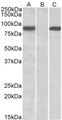 STAT4 Antibody - HEK293 lysate (10ug protein in RIPA buffer) overexpressing Human STAT4 (RC206892) with C-terminal MYC tag probed with (1ug/ml) in Lane A and probed with anti-MYC Tag (1/1000) in lane C. Mock-transfected HEK293 probed (1mg/ml) in Lane