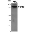 STAT5A Antibody - Western blot of Stat5a antibody