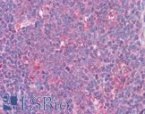 STAT6 Antibody - Anti-STAT6 antibody IHC of human tonsil. Immunohistochemistry of formalin-fixed, paraffin-embedded tissue after heat-induced antigen retrieval. Antibody concentration 5 ug/ml.  This image was taken for the unconjugated form of this product. Other forms have not been tested.
