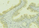 STC2 / Stanniocalcin 2 Antibody - 1:100 staining mouse colon tissue by IHC-P. The sample was formaldehyde fixed and a heat mediated antigen retrieval step in citrate buffer was performed. The sample was then blocked and incubated with the antibody for 1.5 hours at 22°C. An HRP conjugated goat anti-rabbit antibody was used as the secondary.