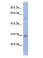 STEAP1B Antibody - STEAP1B antibody Western Blot of Fetal Small Intestine. Antibody dilution: 1 ug/ml.  This image was taken for the unconjugated form of this product. Other forms have not been tested.