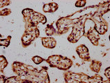 STH Antibody - Immunohistochemistry Dilution at 1:600 and staining in paraffin-embedded human placenta tissue performed on a Leica BondTM system. After dewaxing and hydration, antigen retrieval was mediated by high pressure in a citrate buffer (pH 6.0). Section was blocked with 10% normal Goat serum 30min at RT. Then primary antibody (1% BSA) was incubated at 4°C overnight. The primary is detected by a biotinylated Secondary antibody and visualized using an HRP conjugated SP system.