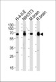 STI1 / STIP1 Antibody - Western blot of lysates from H-4-II-E, mouse NIH/3T3 cell line, mouse brain and rat brain tissues (from left to right), using STIP1 Antibody. Antibody was diluted at 1:1000 at each lane. A goat anti-rabbit (HRP) at 1:5000 dilution was used as the secondary antibody. Lysates at 35ug per lane.