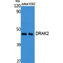 STK17B / DRAK2 Antibody - Western blot of DRAK2 antibody