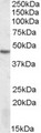 STK17B / DRAK2 Antibody - STK17B antibody (1 ug/ml) staining of MOLT4 lysate (35 ug protein/ml in RIPA buffer). Primary incubation was 1 hour. Detected by chemiluminescence.