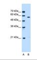 STK3 Antibody - Lane A: Marker. Lane B: Jurkat cell lysate. Antibody concentration: 0.5 ug/ml. Gel concentration: 12%.  This image was taken for the unconjugated form of this product. Other forms have not been tested.