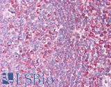 STK38 Antibody - Human Tonsil: Formalin-Fixed, Paraffin-Embedded (FFPE)