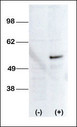 STK38L / NDR2 Antibody - Western blot of anti-STK38L antibody transiently transfected HEK-293 cell line lysate (1 ug/lane). STK38L antibody(arrow) was detected using the purified Pab