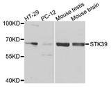 STK39 / SPAK Antibody - Western blot analysis of extracts of various cells.