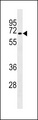 STKLD1 / SgK071 Antibody - SGK071 Antibody western blot of ZR-75-1 cell line lysates (35 ug/lane). The SGK071 antibody detected the SGK071 protein (arrow).