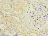 STRADA / LYK5 Antibody - Immunohistochemistry of paraffin-embedded human kidney tissue at dilution 1:100