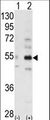 STRADB / ALS2CR2 Antibody - Western blot of ALS2CR2 (arrow) using ALS2CR2 Antibody (C-term L289). 293 cell lysates (2 ug/lane) either nontransfected (Lane 1) or transiently transfected with the ALS2CR2 gene (Lane 2) (Origene Technologies).