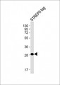 Strep Tag II Antibody - Anti-STREP II TAG Antibody at 1:4000 dilution + A recombinant protein with STREP?-tag Lysates/proteins at 20 µg per lane. Secondary Goat Anti-mouse IgG, (H+L), Peroxidase conjugated at 1/10000 dilution. Predicted band size: 30 kDa Blocking/Dilution buffer: 5% NFDM/TBST.